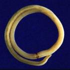 <i>Ascaris lumbricoides</i> infects one in four people worldwide