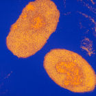 The Bordetella pertussis bacterium