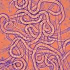 <EM>Brugia malayi</EM> worms