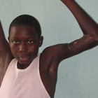 Boy with Buruli ulcer