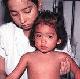 Dengue fever is a particular threat to children in areas such as South East Asia