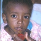 Infant taking DOTS drugs