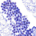 Dengue virus