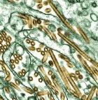 An electron micrograph of H5N1 viruses