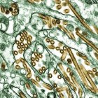 A slide of the H5N1 virus