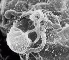 Virus VIH-1 hospedado en un linfócito