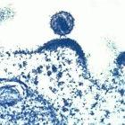 HIV budding out of a human immune cell
