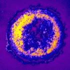 Oral HIV tests could be used in resource-poor areas