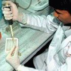 Testing for HIV in Jaipur, India
