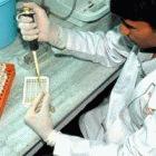 Testing for HIV in Jaipur, India