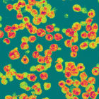 HIV particles HIV particles