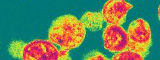 HIV particles;R Dourmashkin/Wellcome Images