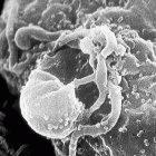 The HIV virus