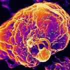 The HIV virus