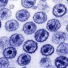 The HIV virus