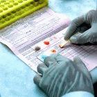 Testing for HIV at Swasthya Kalyan Blood Bank in
Jaipur, India.