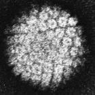 Human papilloma virus
