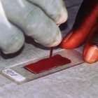malaria testing