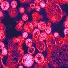 Lassa virus particles