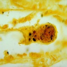 Photomicrograph of kidney tissue, using a silver staining technique, revealing the presence of Leptospira bacteria.