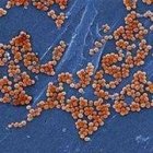 mrsa mrsa