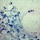 Healthcare workers in developing countries have been found to have higher levels of latent TB than the general population