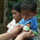 Malnutrition