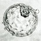 Human blastocyst, the early form of embryo from which stem cells can be taken