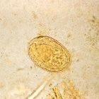 A <i>Schistosoma japonicum</i> egg