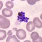 Plasmodium vivax parasite bursting out of a human red blood cell