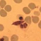 <i>Plasmodium falciparum</i>