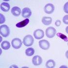 Scientists found Plasmodium falciparum prevalent in Nigerians' blood