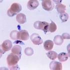 Plasmodium falciparum