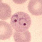 Two ring-form <i>Plasmodium vivax</i> trophozoites inside a red blood cell