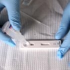Rapid diagnostic tests (RDTs)