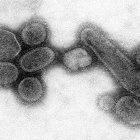The reconstructed 1918 Spanish flu virus