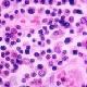 Typhoid-causing <i>Salmonella typhi</i> bacteria