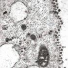 The SARS virus