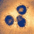 The SARS virus