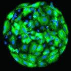 Human embryonic stem cells that are becoming epithelial cells