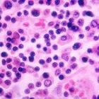 A view through a microscope of Salmonella enterica typhi in a lymph node