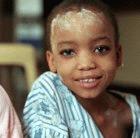 Msizi, 4-years-old, a TB patient in South Africa