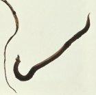 The parasite that causes schistosomiasis