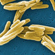 Mycobacterium tuberculosis bacteria