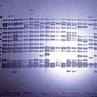A gel of <i>Mycobacterium tuberculosis</I> DNA