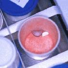 DOTS drugs for an infant in an Addis Ababa hospital, Ethiopia.  