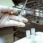 The fund will encourage innovation in areas such as TB research