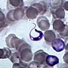 <i>Trypanosoma cruzi</i>