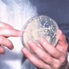 Collecting yeast cells for malaria vaccine research in China