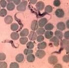 The <i>Trypanosome brucei</i> parasite